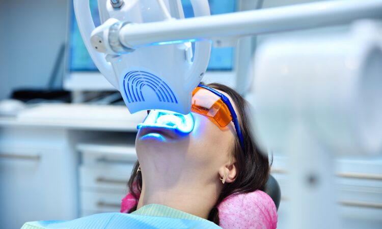 6 Reasons to Choose Professional Teeth Whitening